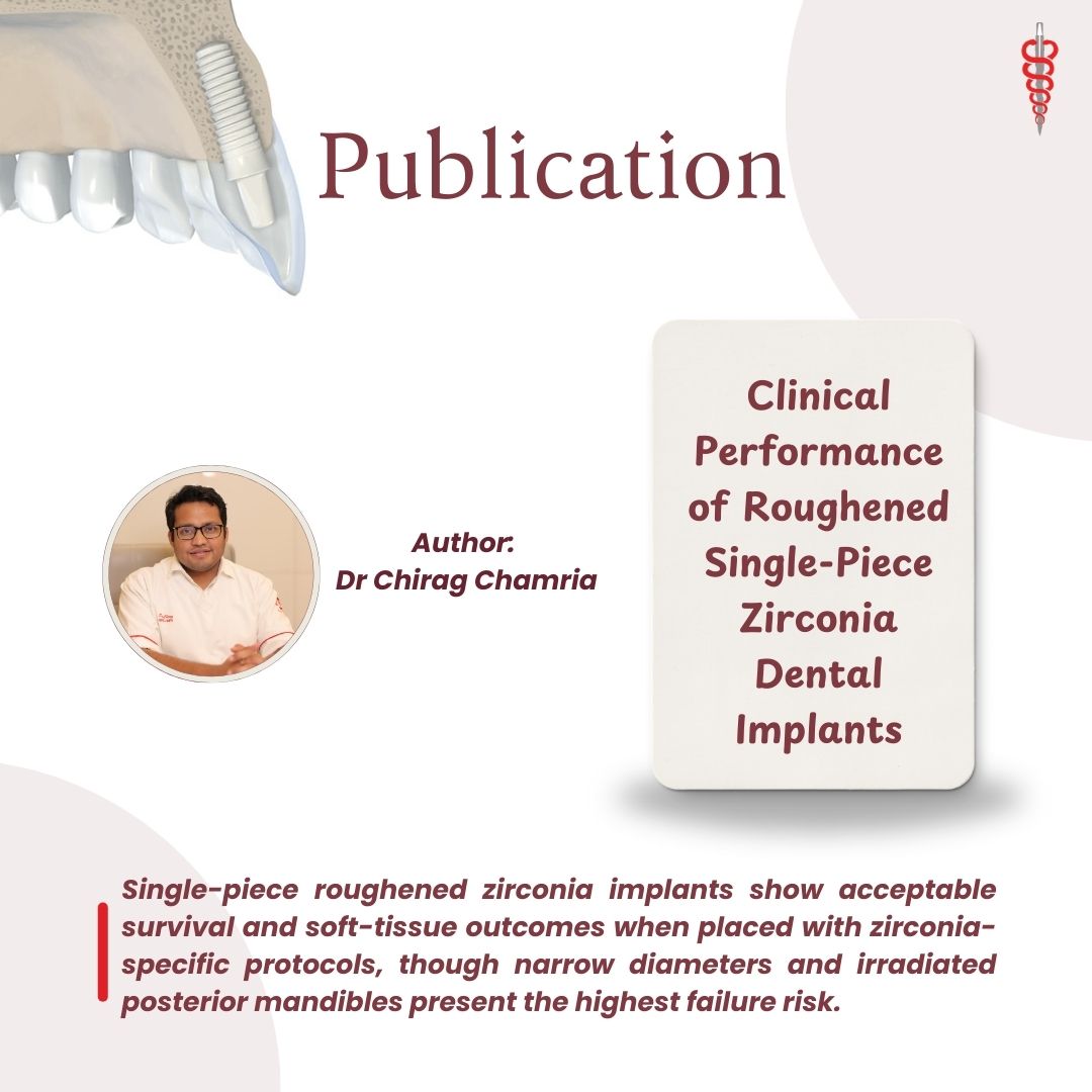 Zygomatic Dental Implant